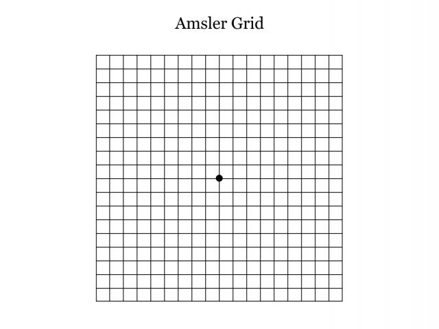 Amsler Grid that helps determine vision problems