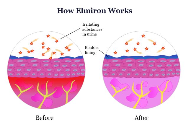 How Elmiron Works