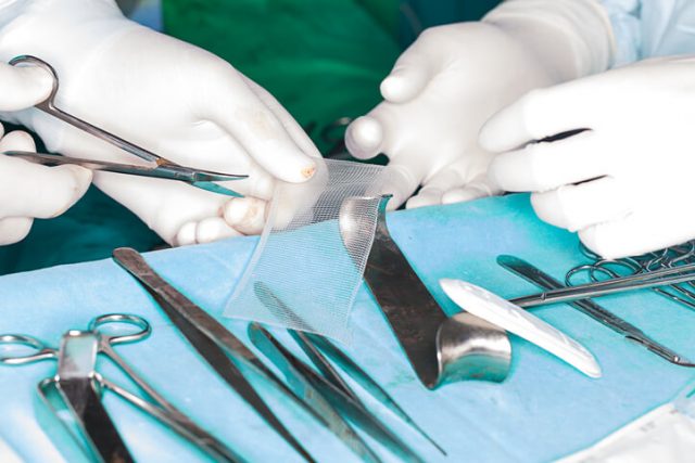 Doctors cutting hernia mesh