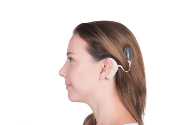 Woman with cochlear implant in ear