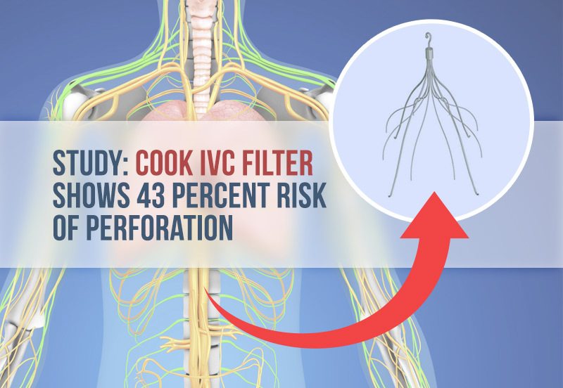 Illustration of human body and Cook IVC Filters