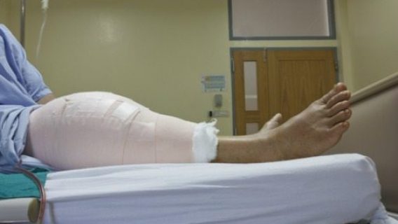 knee in bandages
