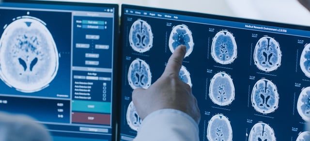 Doctors examine brain x-rays