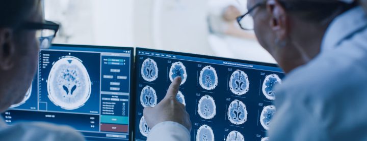 Doctors viewing brain scans