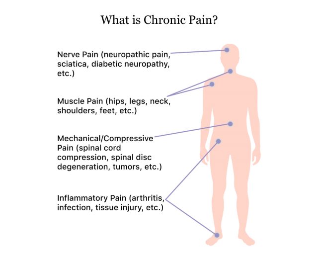 How chronic pain affects different parts of the body