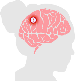 Brain Tumor Diagram