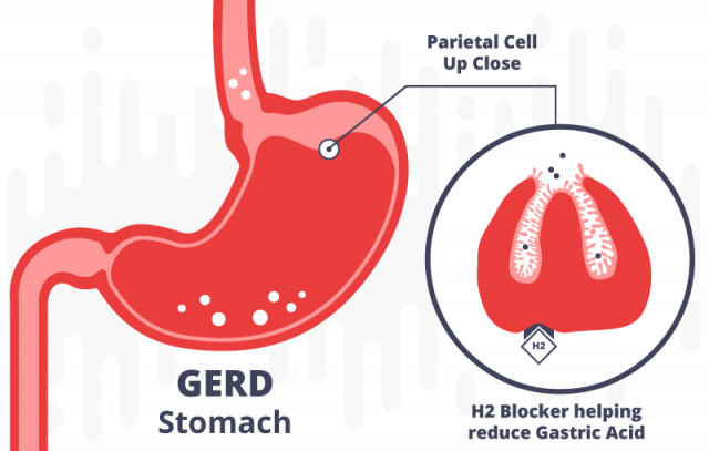 how H2 blockers reduce gastric acid