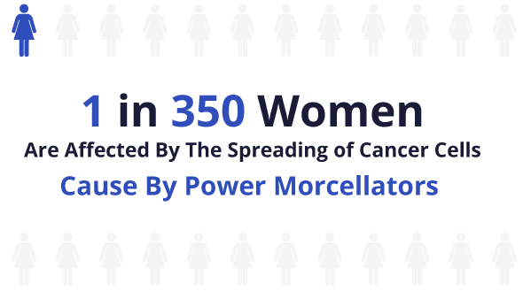 1 in 350 women are affected by the spreading of cancer cells caused by power morcellators