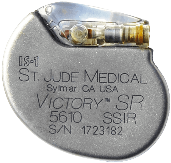 St. Jude Medical Defibrillator Implant