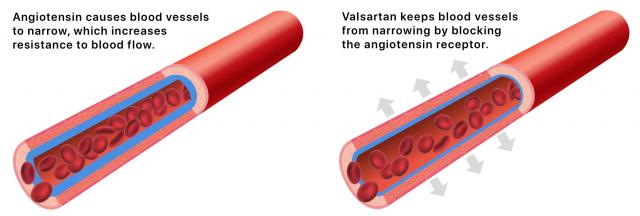 Illustration of how Valsartan releases high blood pressure in blood vessels.